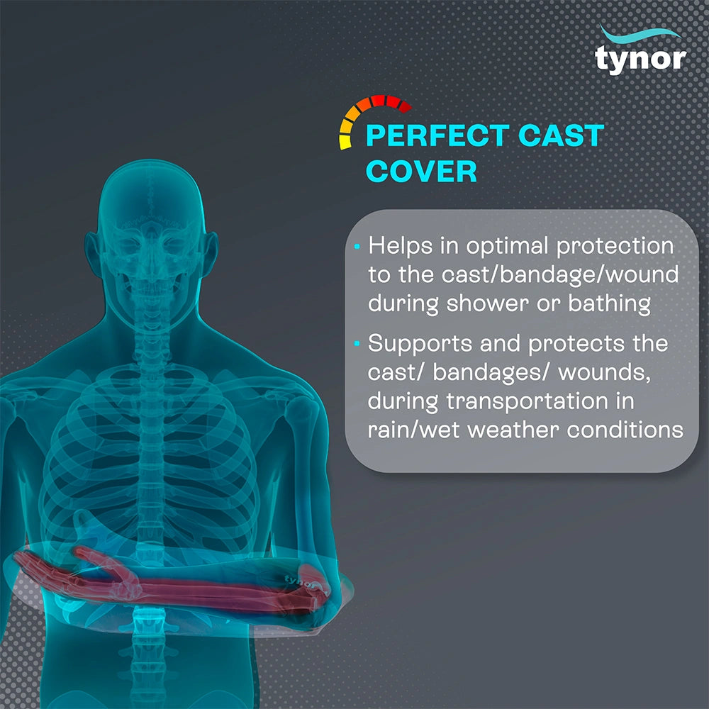 Cast Cover arm