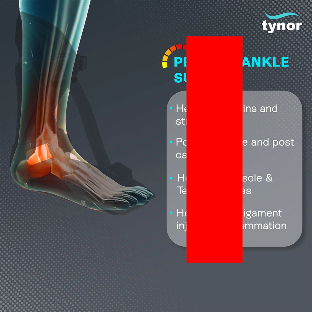 PF Night Splint Derotation