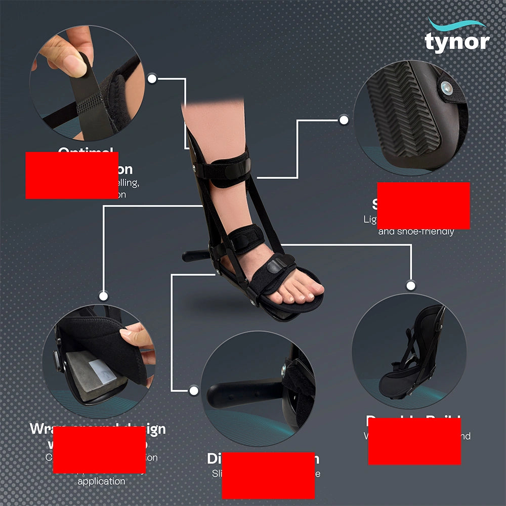 PF Night Splint Derotation