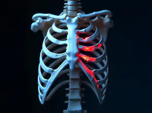 Broken Ribs: Symptoms, Causes, and Treatment