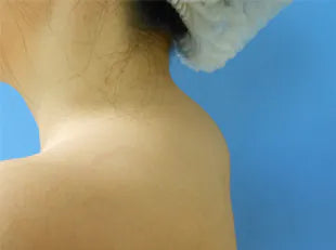 Effective Ways to fix neck hump