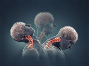Understanding Whiplash Injury: Causes and Treatment
