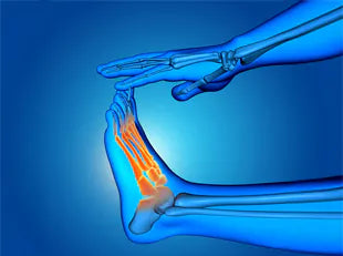 What is Plantar Fasciitis? Symptoms and Causes