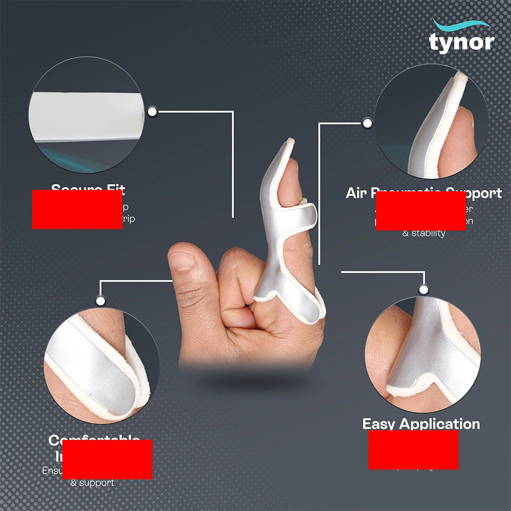 Frog Splint